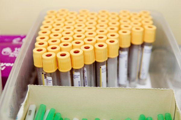Is my bones diagnosed with vitamin D deficiency normal? Professor reveals the truth about the concentration of vitamin D